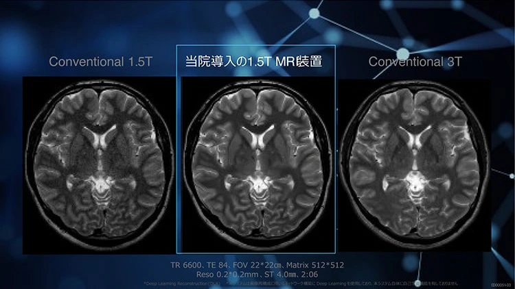 当院導入の1.5T MR装置