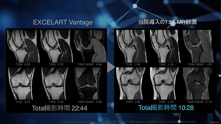当院導入の1.5T MR装置
